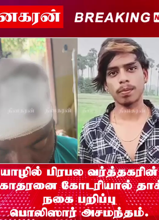 யாழில் பிரபல வர்த்தகரின் சகோதரனை கோடரியால் தாக்கி நகை பறிப்பு; பொலிஸார் அசமந்தம்.!