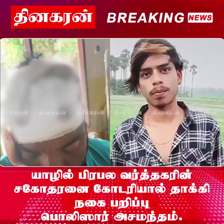 யாழில் பிரபல வர்த்தகரின் சகோதரனை கோடரியால் தாக்கி நகை பறிப்பு; பொலிஸார் அசமந்தம்.!